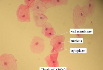 human cheek cells - pink blobs with dark pink dots inside each one on a yellow background